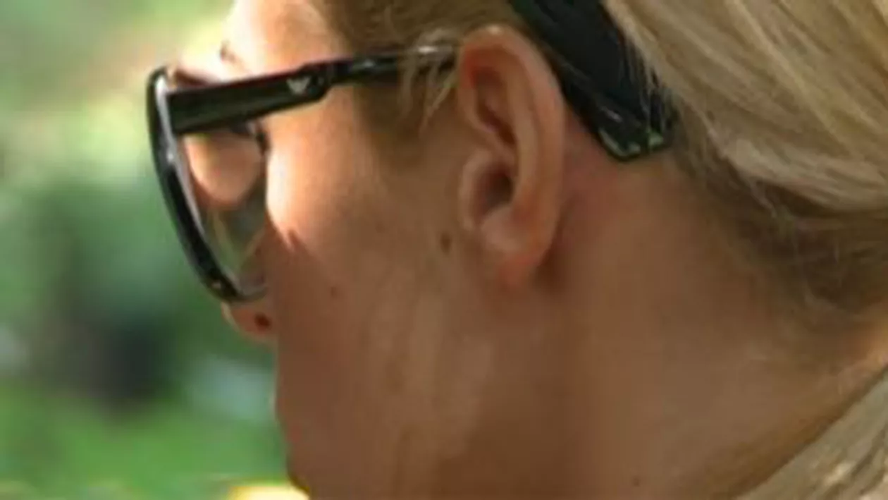 Mutilată de dragul frumuseții: O tânără a ajuns la spital cu arsuri după un banal tratament împotriva coșurilor (VIDEO)