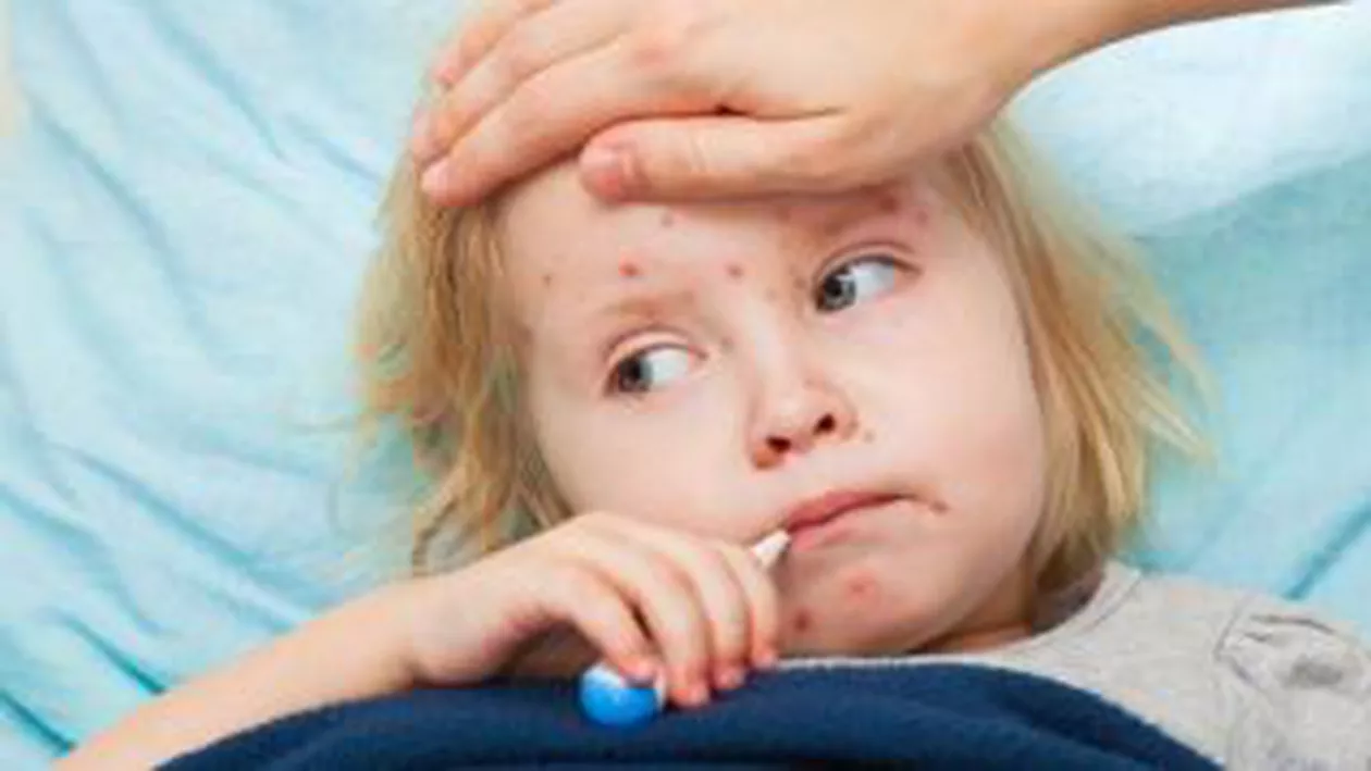 Europa, sub ameninţarea epidemiilor. România, printre ţările cu cea mai mare epidemie de pojar din ultimii ani