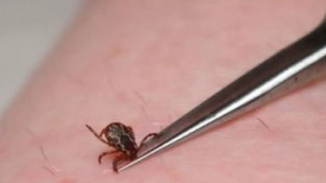 Brățară anti-căpușe, disponibilă pe Internet și în farmacii. Vezi cât te costă să ții insectele la distanță