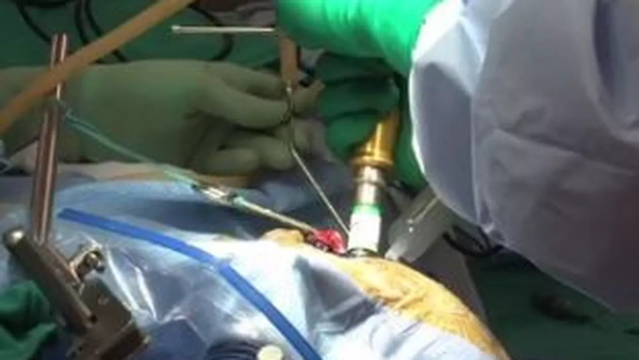 Chirurg din Petroșani, acuzat de malpraxis după ce a operat un copil de trei ani la o mână sănătoasă