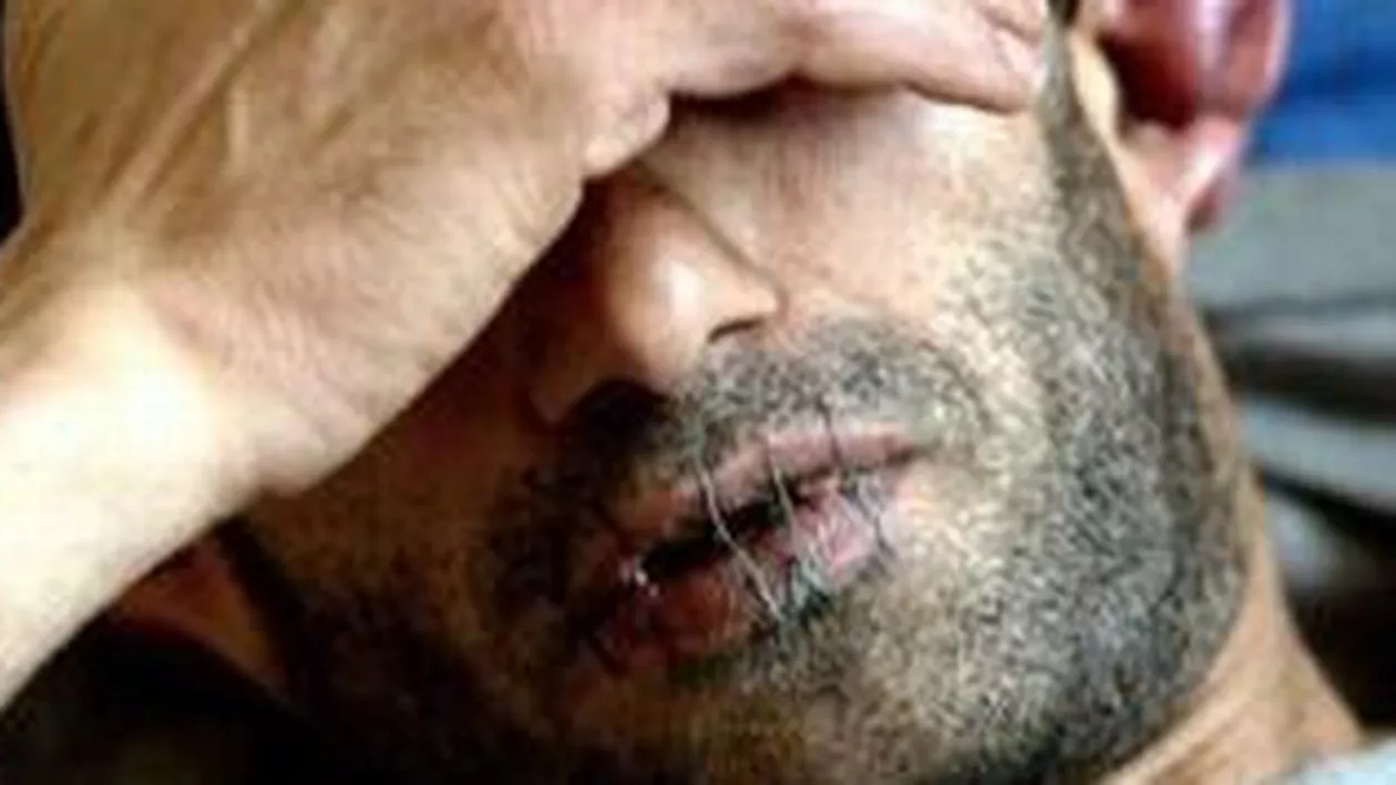Gest extrem la Penitenciarul Colibași: Un deţinut şi-a cusut buzele cu o sârmă și și-a bătut un cui în cap