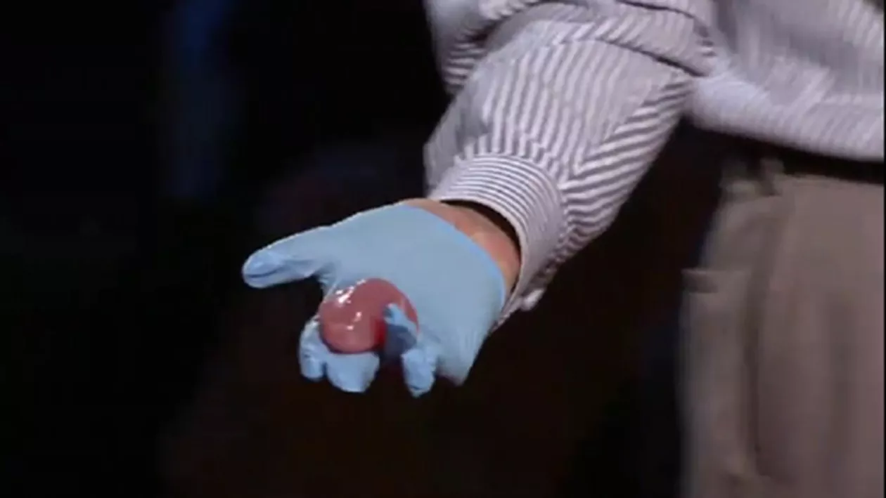Printarea unui rinichi uman în România va putea fi posibilă de anul viitor: Guvernul va finanța dezvoltarea imprimantelor 3D (VIDEO)