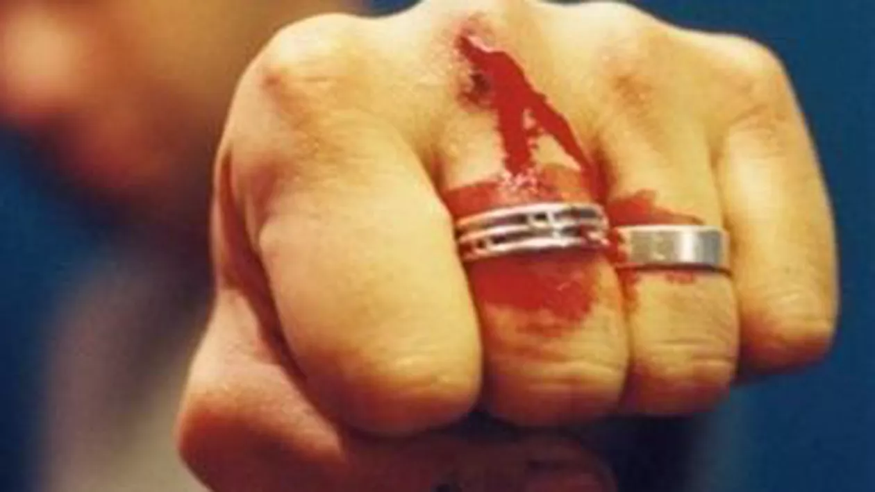Tineri suceveni, cercetați de poliție pentru lovire și alte violențe: Trei au fost internați în spital din cauza rănilor