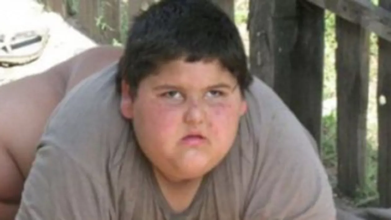 Dolj: Băiatul de 6 ani care cântărea 120 de kilograme a murit la spital