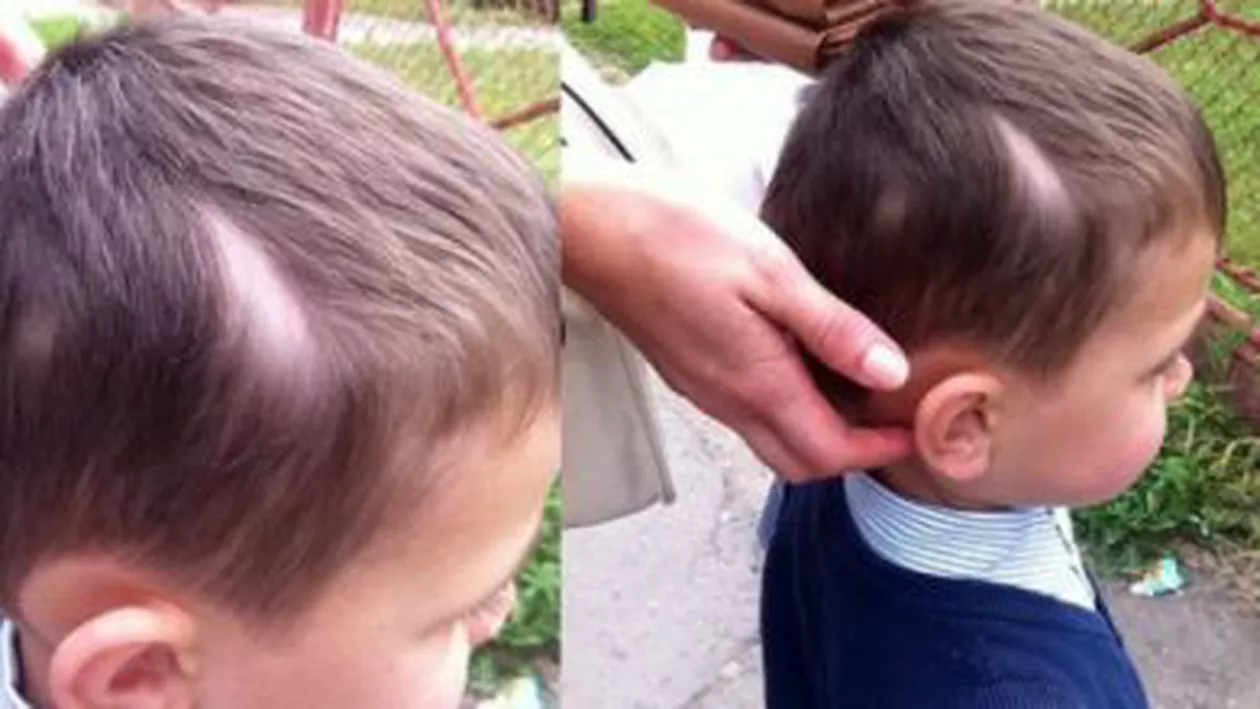 Copil de trei ani, mutilat la o creșă din Suceava