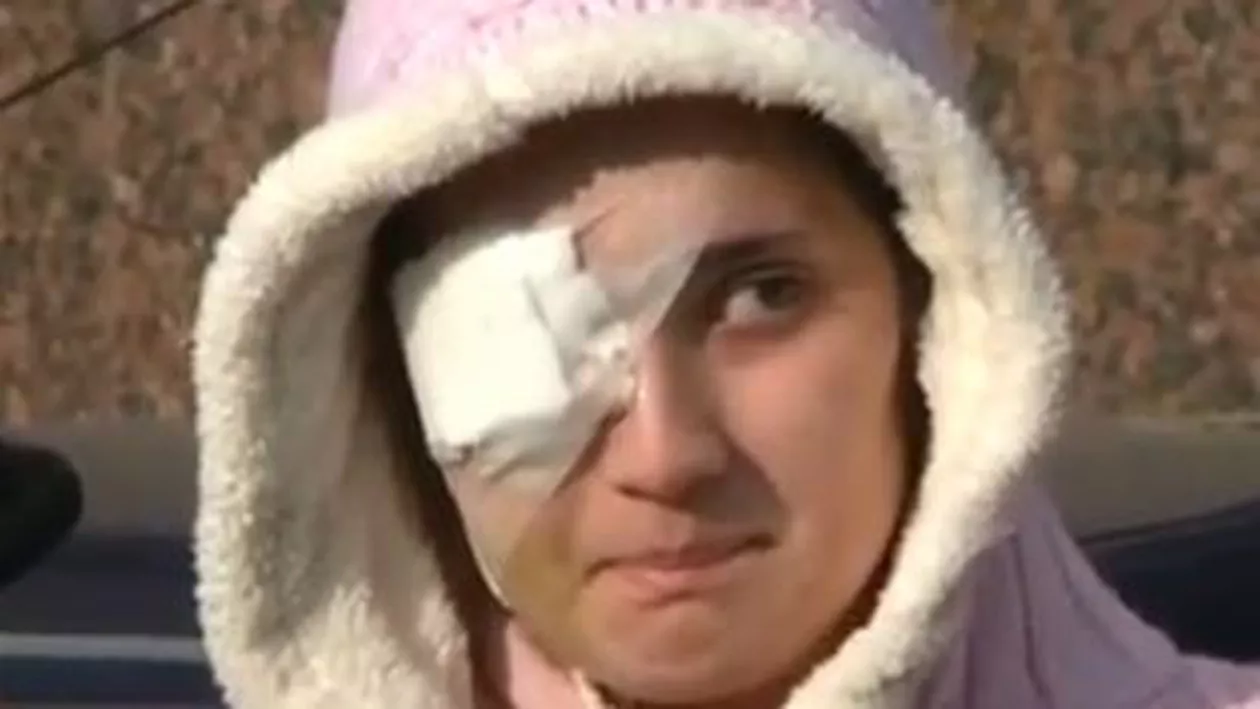Audieri în cazul atacului armat din Militari: Tânăra care a rămas fără un ochi, părăsită de iubit