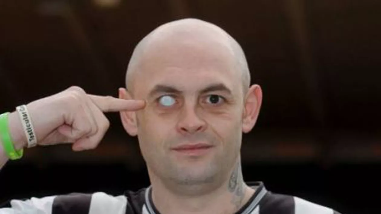 Un britanic și-a inscripționat emblema echipei de fotbal favorite pe ochiul de sticlă