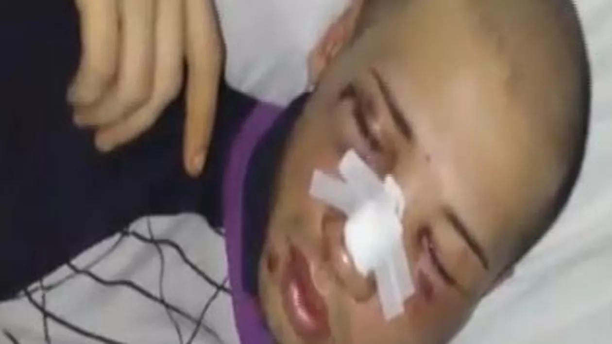 Bucureștean desfigurat, pentru că a refuzat să plătească dublu la magazin (VIDEO)