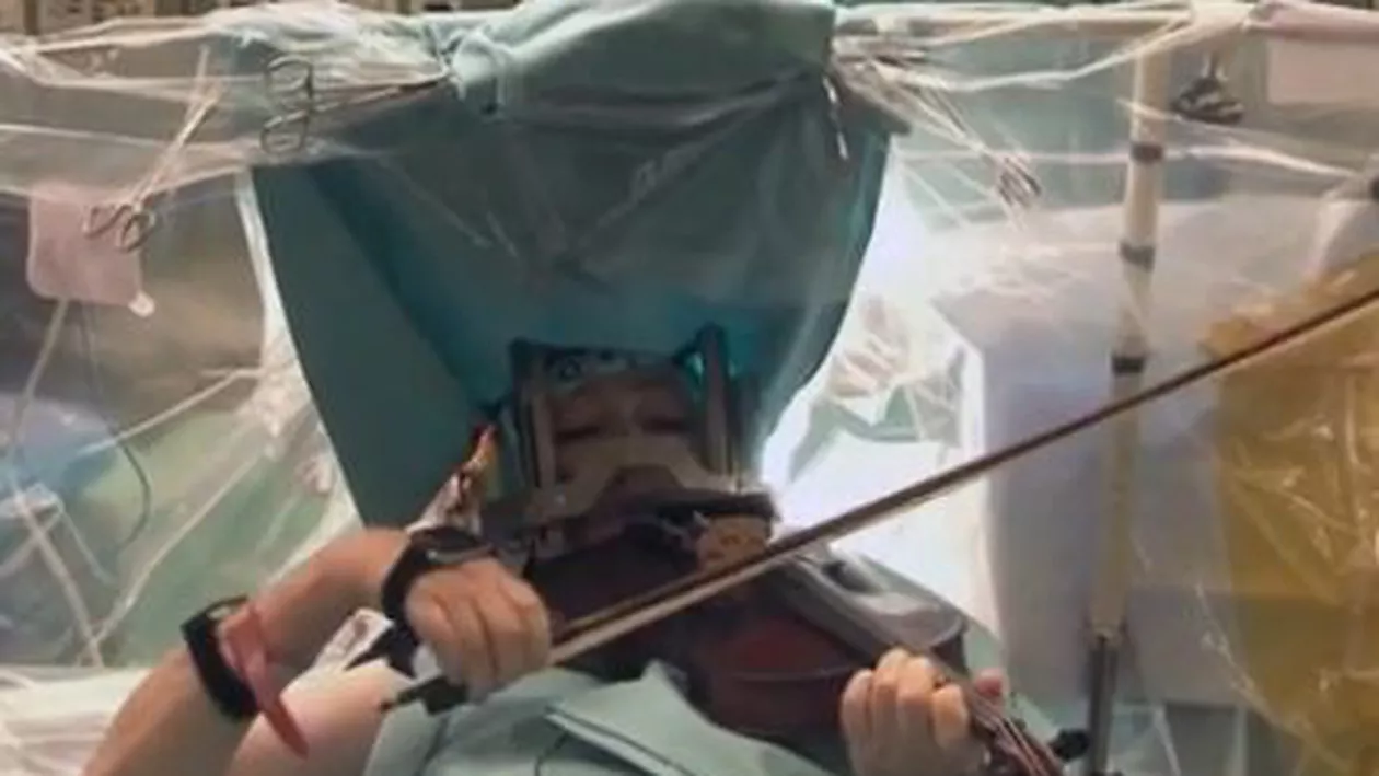 Lituania: O violonistă a cântat la vioară în timp ce era operată pe creier (VIDEO)