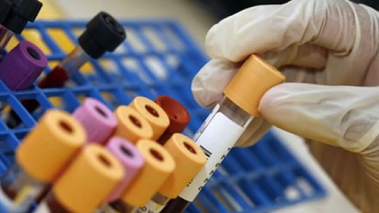 Experimentul unui bărbat de 47 de ani: A făcut aceleași analize în 3 laboratoare diferite, iar rezultatele nu sunt la fel