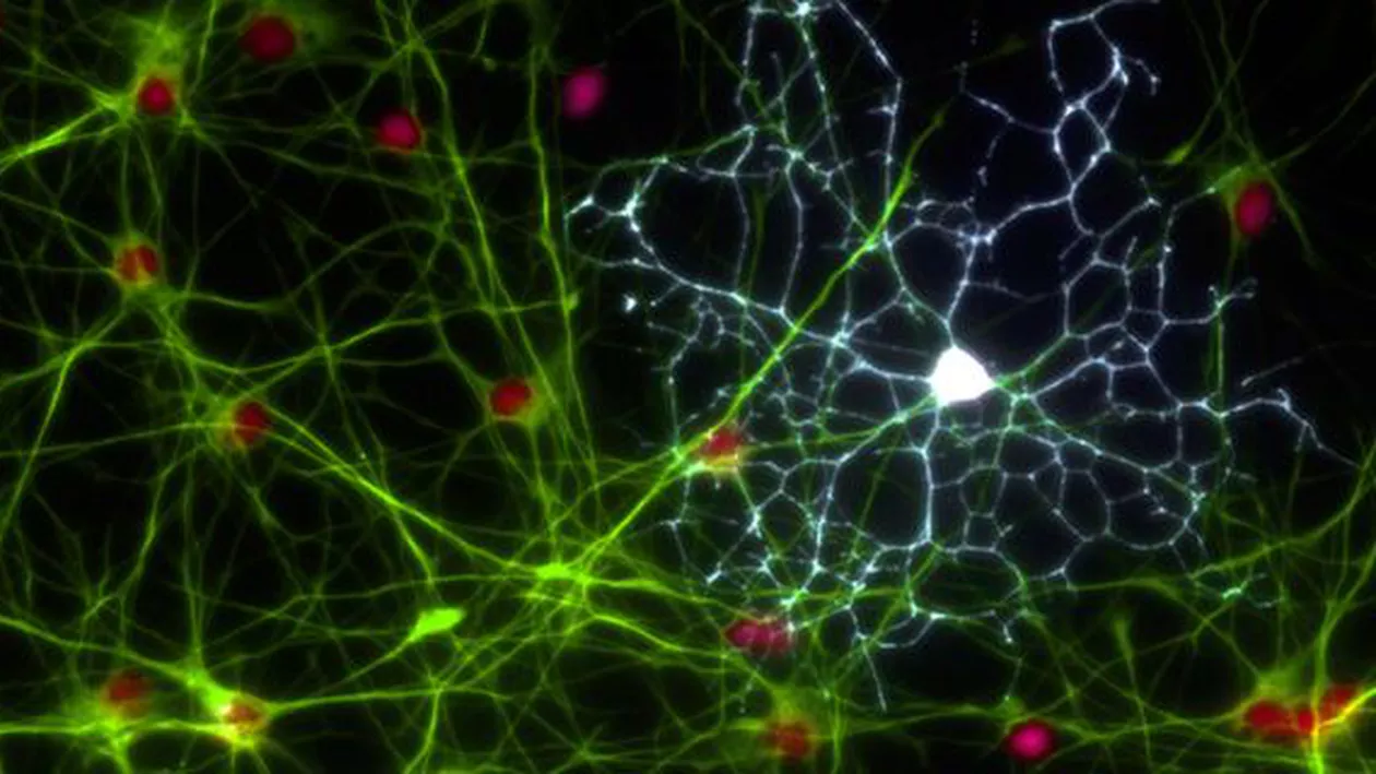 Studiu: Specialiştii americani în ştiinţe neuronale au descoperit o legătură directă între creier şi sistemul imunitar