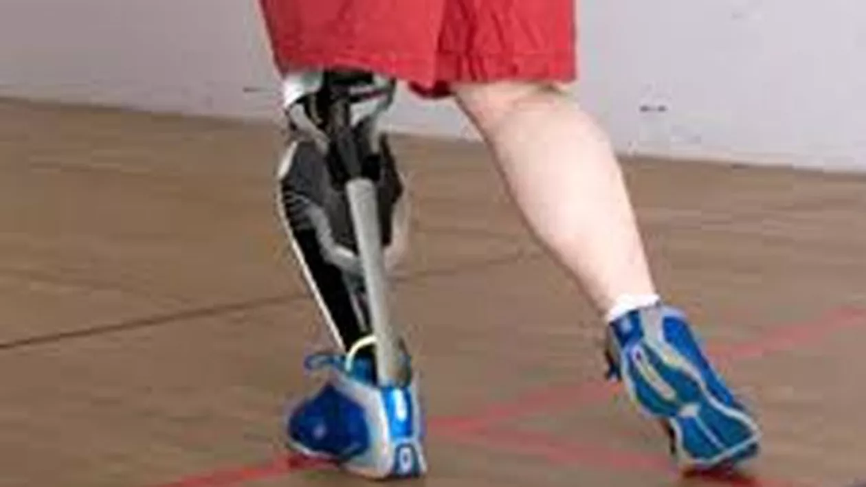 Premieră mondială: A fost inventată proteza de picior care preia senzațiile membrului amputat