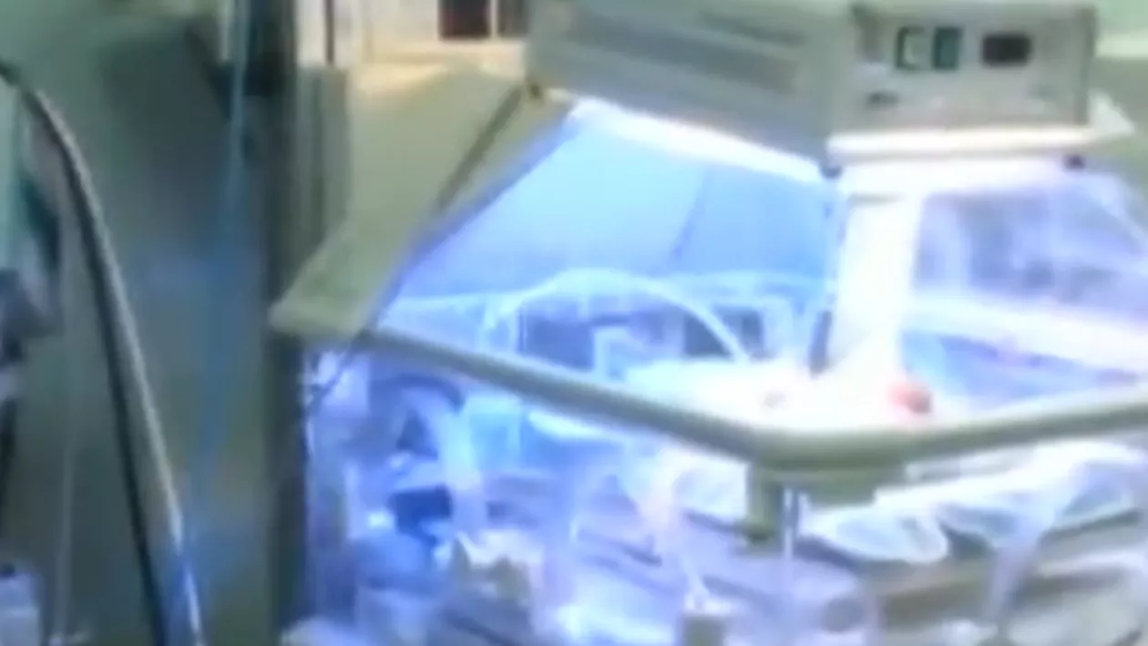 Siamezele internate la Spitalul ”Marie Curie” sunt în stare stabilă, dar, în acest moment, este aproape imposibil ca fetiţele să fie separate (VIDEO)