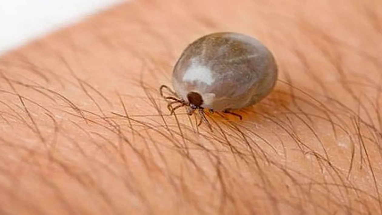 Au reapărut căpușele: Doi buzoieni au ajuns în spital după ce au fost mușcați de insectele parazite
