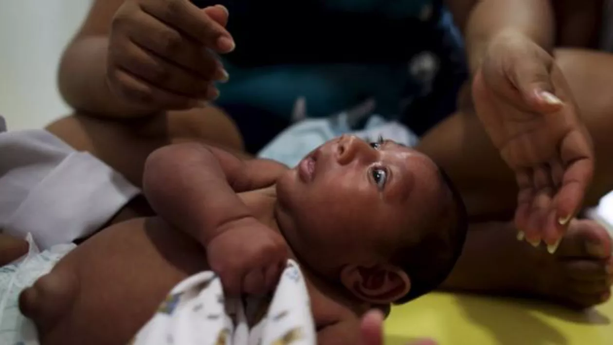 Spania: Primul caz de microcefalie legat direct de virusul Zika, la un nou-născut