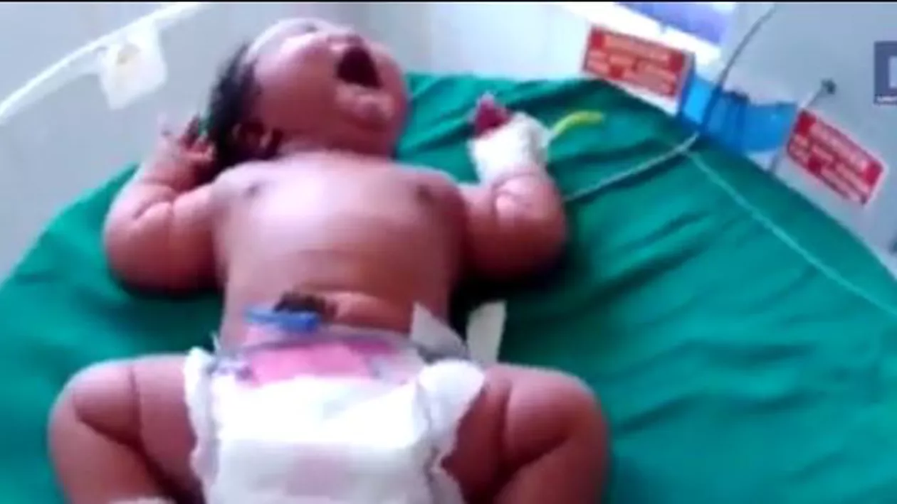 Record la naștere în India! Bebelușul a avut o greutate de aproape 7 kilograme (VIDEO)