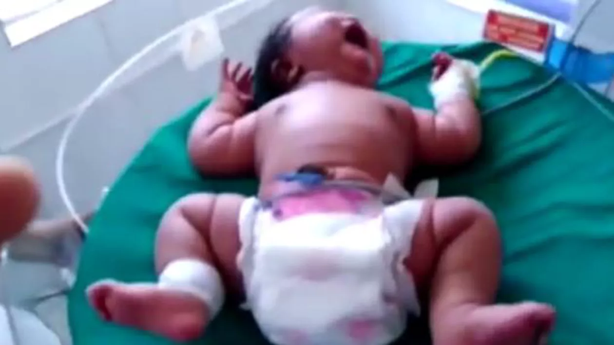 O fetiță de 6,8 kilograme a fost născută de o femeie din India (VIDEO)