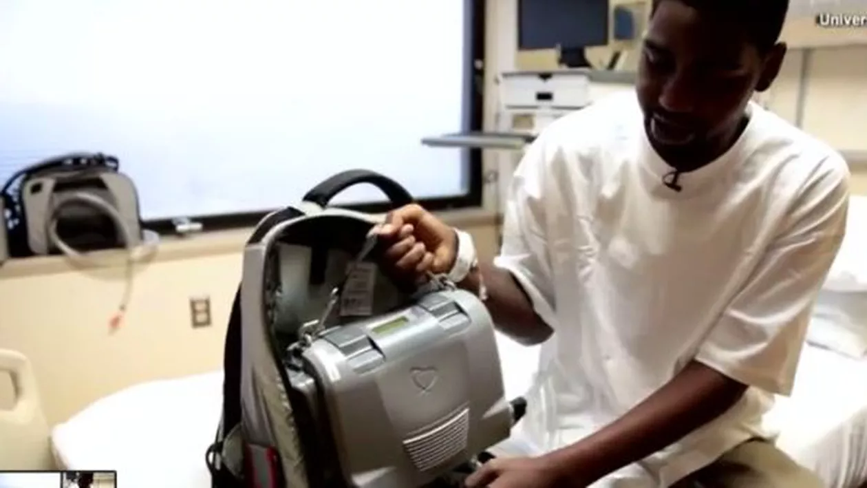 Un bărbat a trăit fără inimă timp de un an. Cum a fost posibil acest lucru (VIDEO)