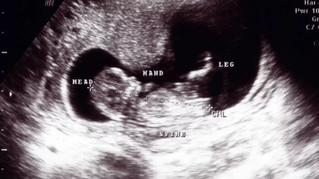 SUA: Curtea Supremă a declarat ilegală legea texană cu privire la avorturi