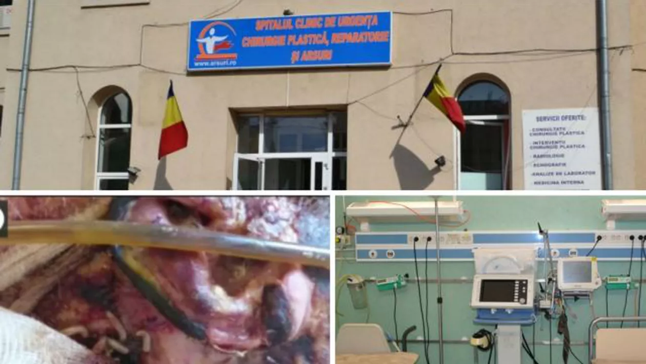 "Viermii apar în fiecare vară la Spitalul de Arși!”: O infirmieră spune că și celălalt pacient pe care s-au găsit lave a murit acum două zile (VIDEO)
