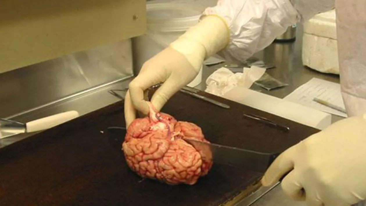 Cea mai mare bancă de creier din lume: Peste 9.000 de mostre au trecut prin această instituție (FOTO)