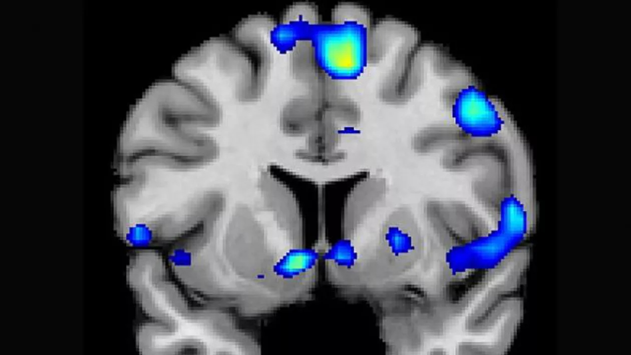 Cercetătorii au descoperit că religia, câştigurile materiale sau consumul de droguri au acelaşi efect asupra creierului