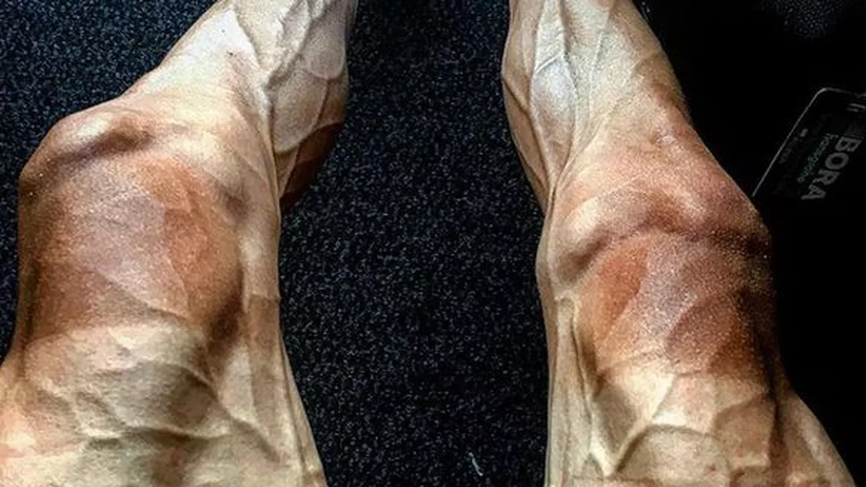 N-AI MAI VĂZUT AȘA CEVA: Cum arată gambele unui CICLIST de la Turul Franței!!