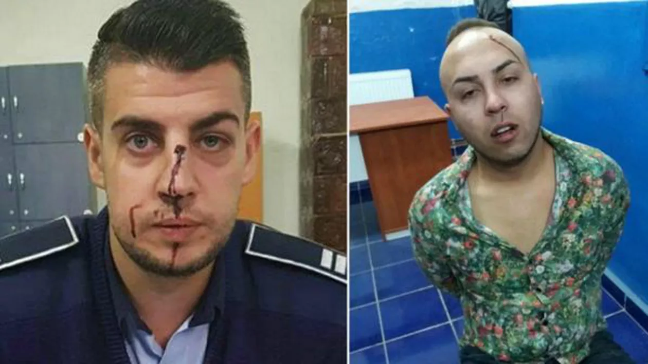 Polițist bătut în misiune la Dolj. Sindicat:  Bă Dragnea.... Bă! Olga! Să vă fie rușine, domnilor politicieni! (VIDEO, FOTO)