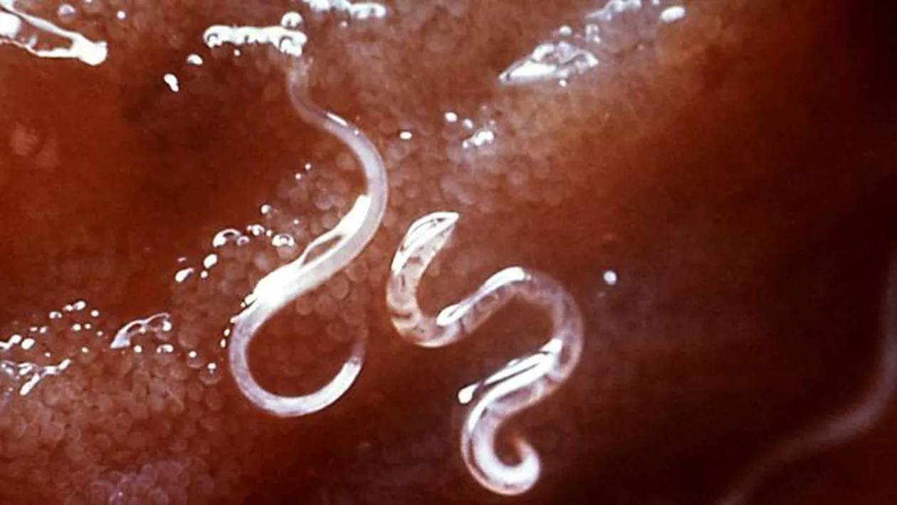 Mai mulţi oameni s-au oferit VOLUNTARI pentru a fi injectaţi cu paraziţi mortali