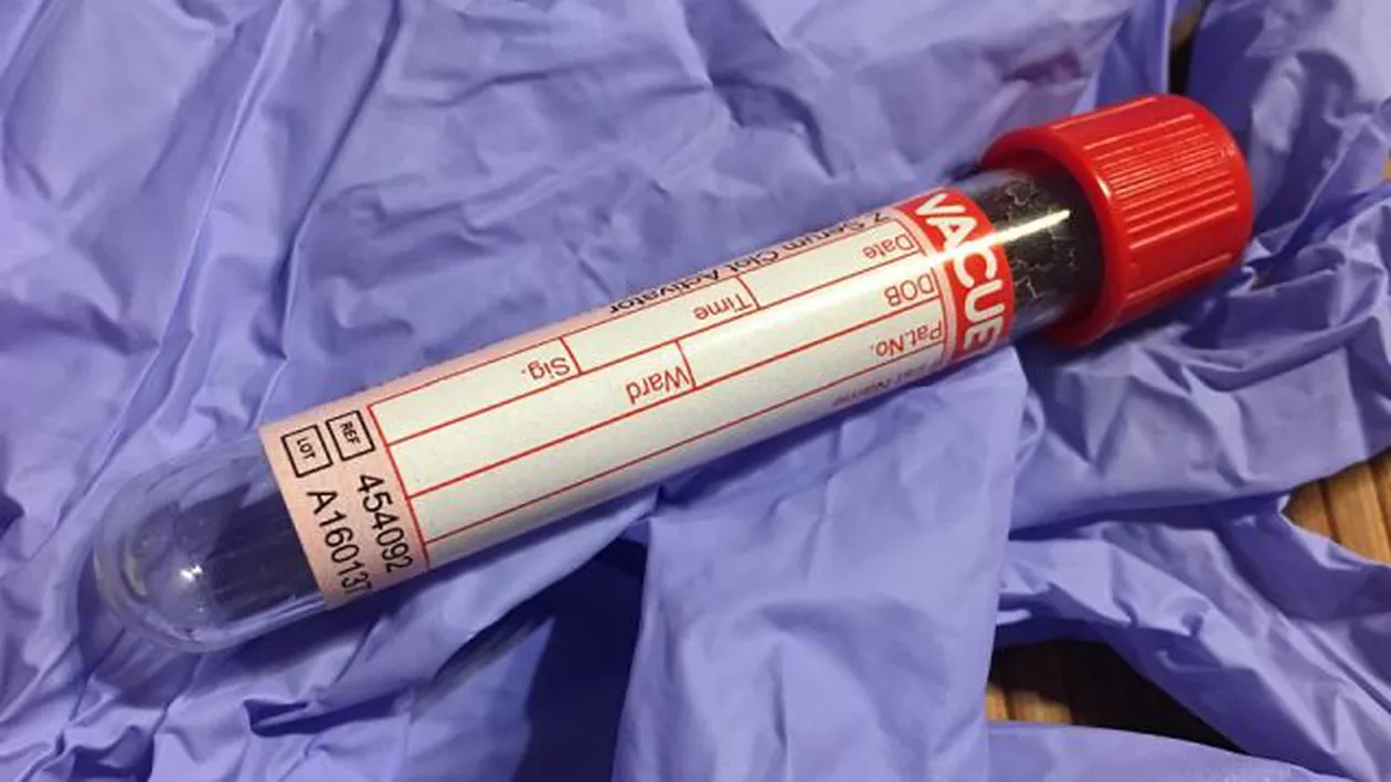 România, lovită de un virus care afectează milioane de oameni din întreaga lume. În ce zone s-au raportat cele mai multe îmbolnăviri