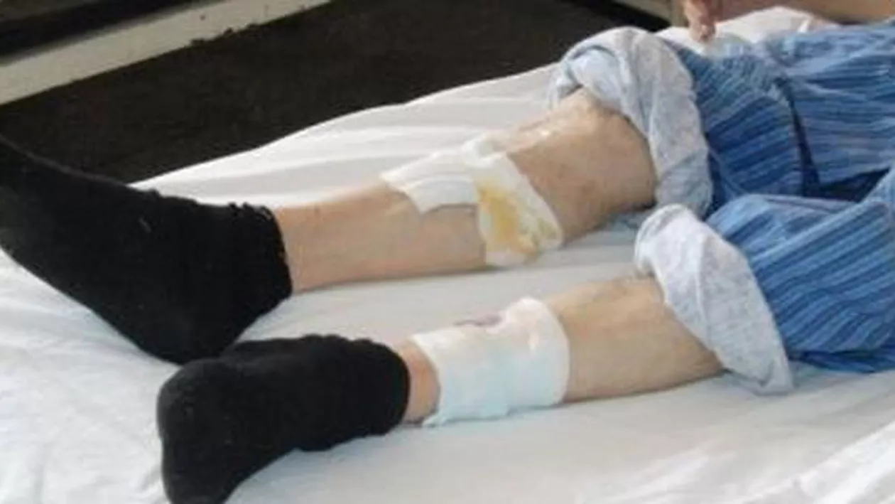 Galați: Cântăreţul preferat al lui Ceauşescu, în stare gravă la spital (FOTO)