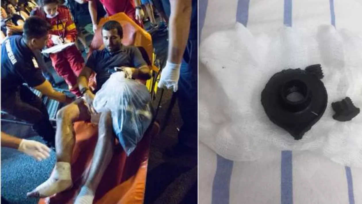 Protestatarul rănit de o grenadă în 10 august: Dragnea felicită jandarmii așa cum Iliescu felicita minerii