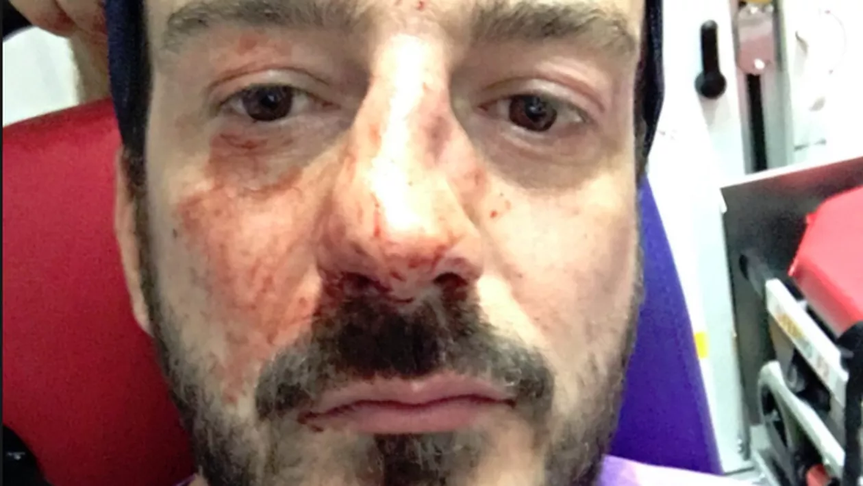 Un activist LGBT, UMPLUT de SÂNGE în plină stradă: 'Ar trebui ca toţi să fiţi ARŞI!' (FOTO)