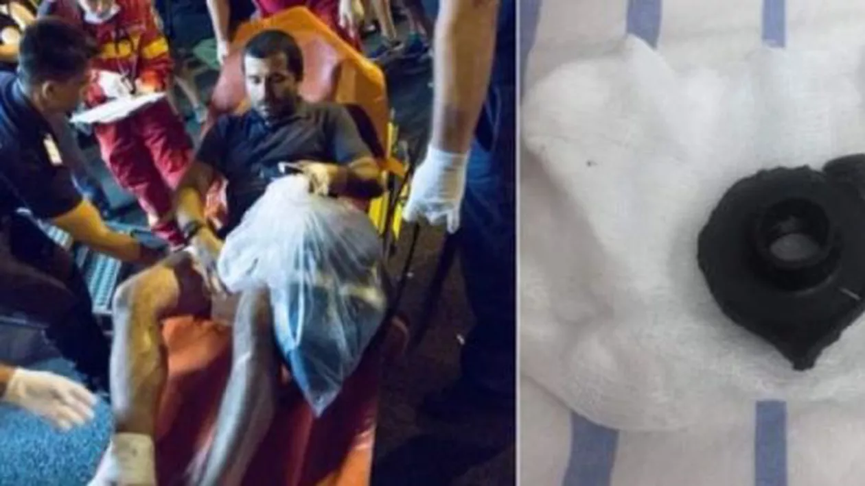 Protestatarul rănit pe 10 august de capacul unei grenade pleacă din România: Țara pe care am dorit să o salvez a decis să mă împuște. La propriu