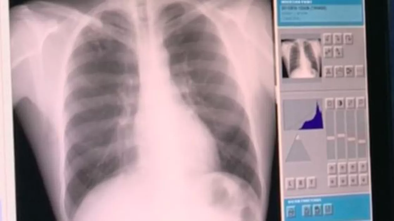 Descoperire neașteptată în Slatina: Trei medici au dosit în vestiare 140 de radiografii (VIDEO)