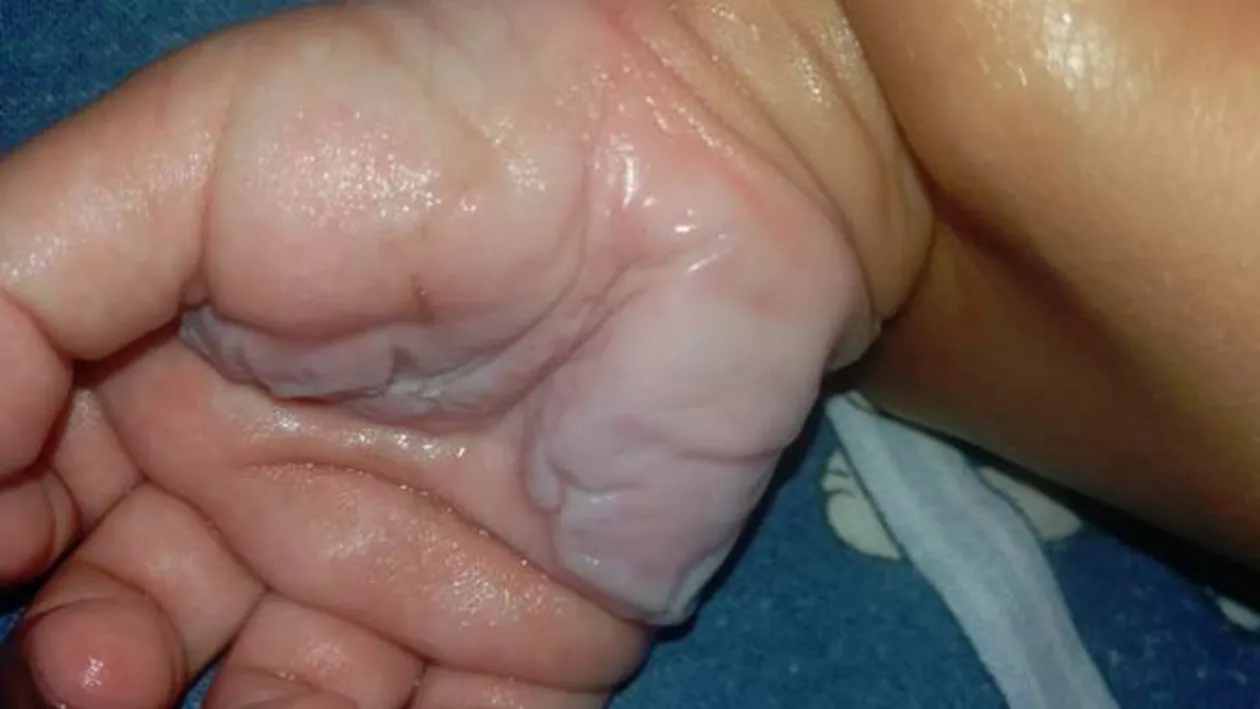 O mamă acuză personalul de la Spitalul din Videle: ''Jeguri de asistente! Mi-au nenorocit copilul, din cauză că nu au ele chef dacă își scoate copilul branula să îi pună alta!'' /  Reacția conducerii spitalului