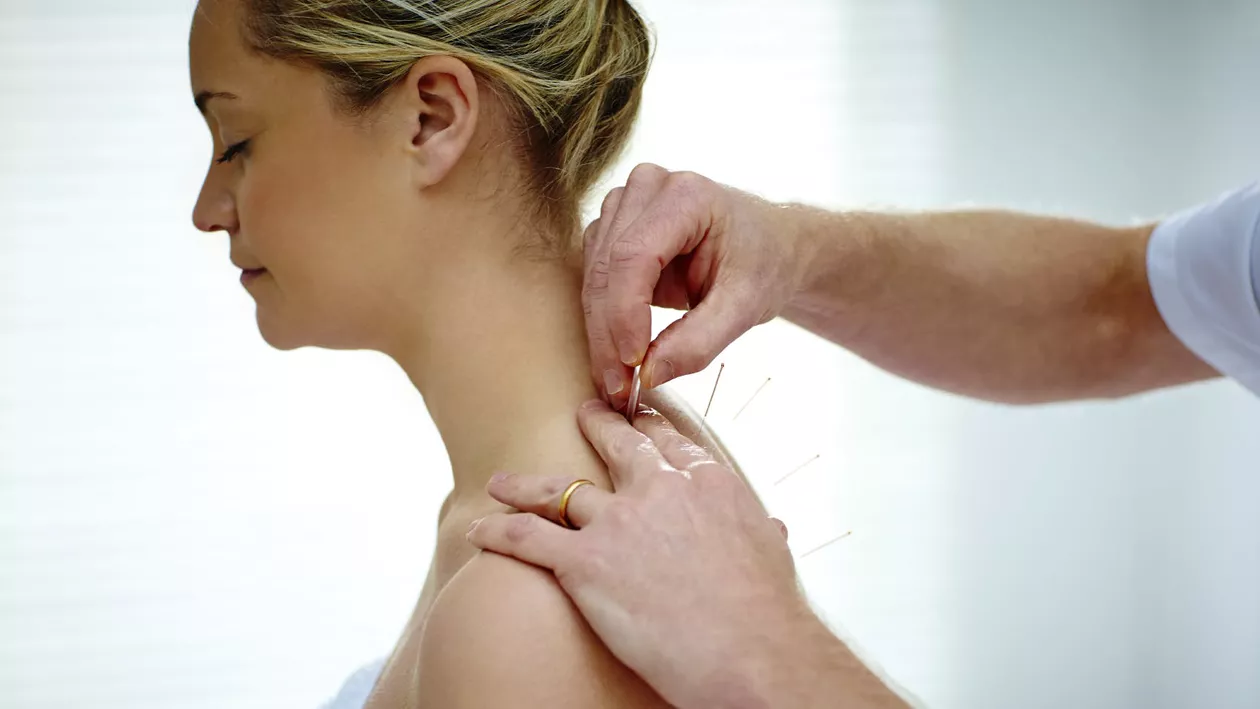 (P) Ce trebuie să stiți despe doctorii care practică acupunctura