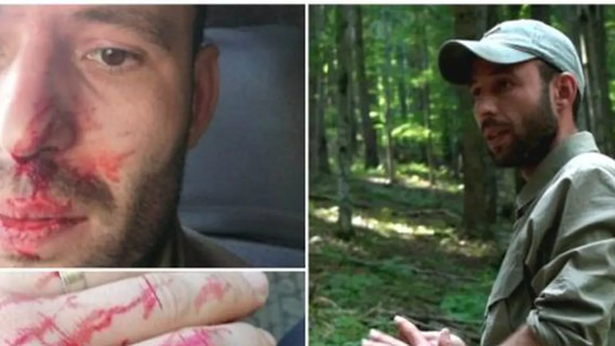 REVOLTĂTOR! MAFIA LEMNULUI acaparează România! La o zi după crima din Maramureș, un pădurar a fost bătut și amenințat cu moartea de un afacerist din Suceava (FOTO)