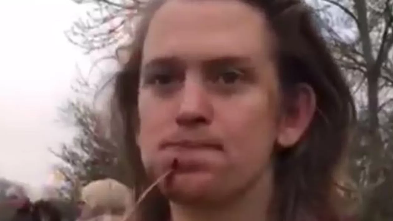 Metoda incredibilă folosită de un tânăr rugbist pentru a trata o tăietură suferită în timpul meciului (VIDEO)