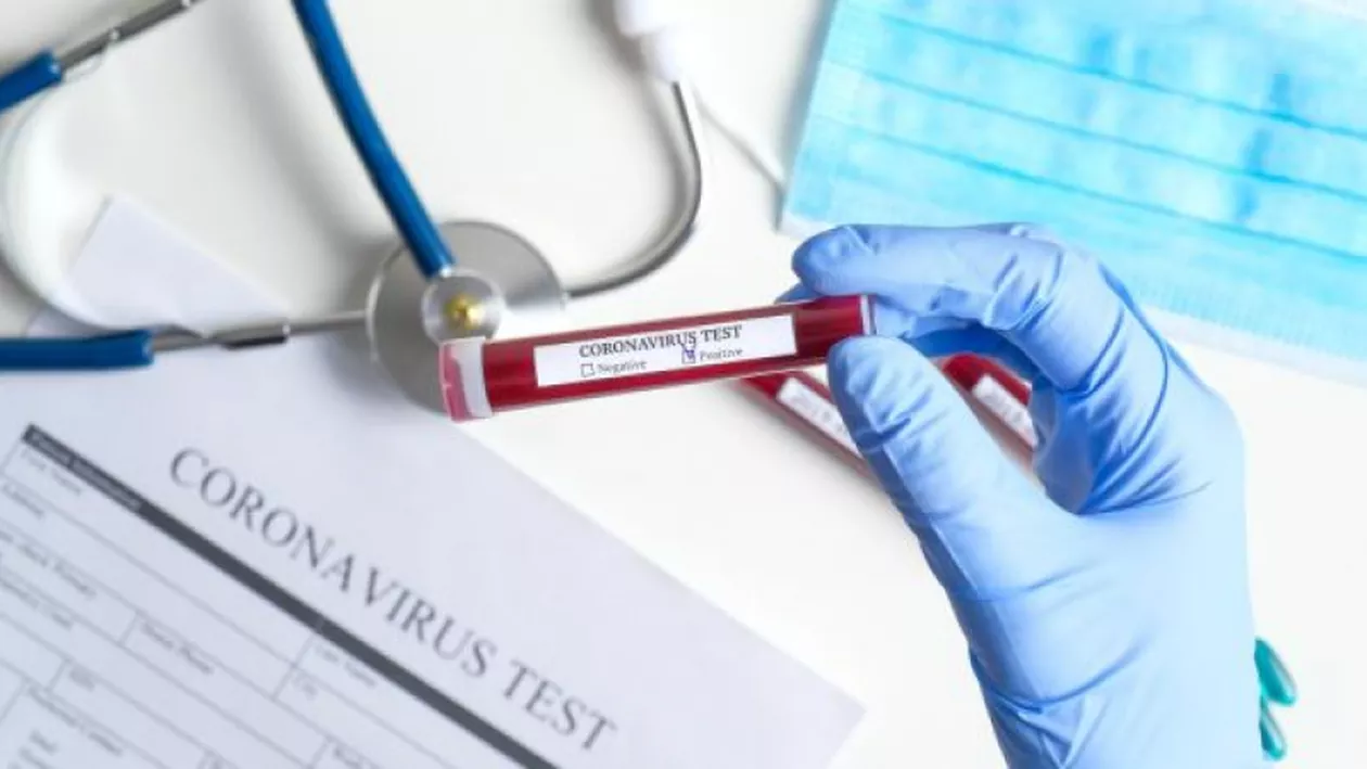 CORONAVIRUS. Bilanțul îmbolnăvirilor cu COVID-19 ajunge la 12.567, dintre care 327 înregistrate în ultimele 24 de ore. La terapie intensivă sunt 249 de pacienți, iar peste 4.300 de persoane au fost vindecate
