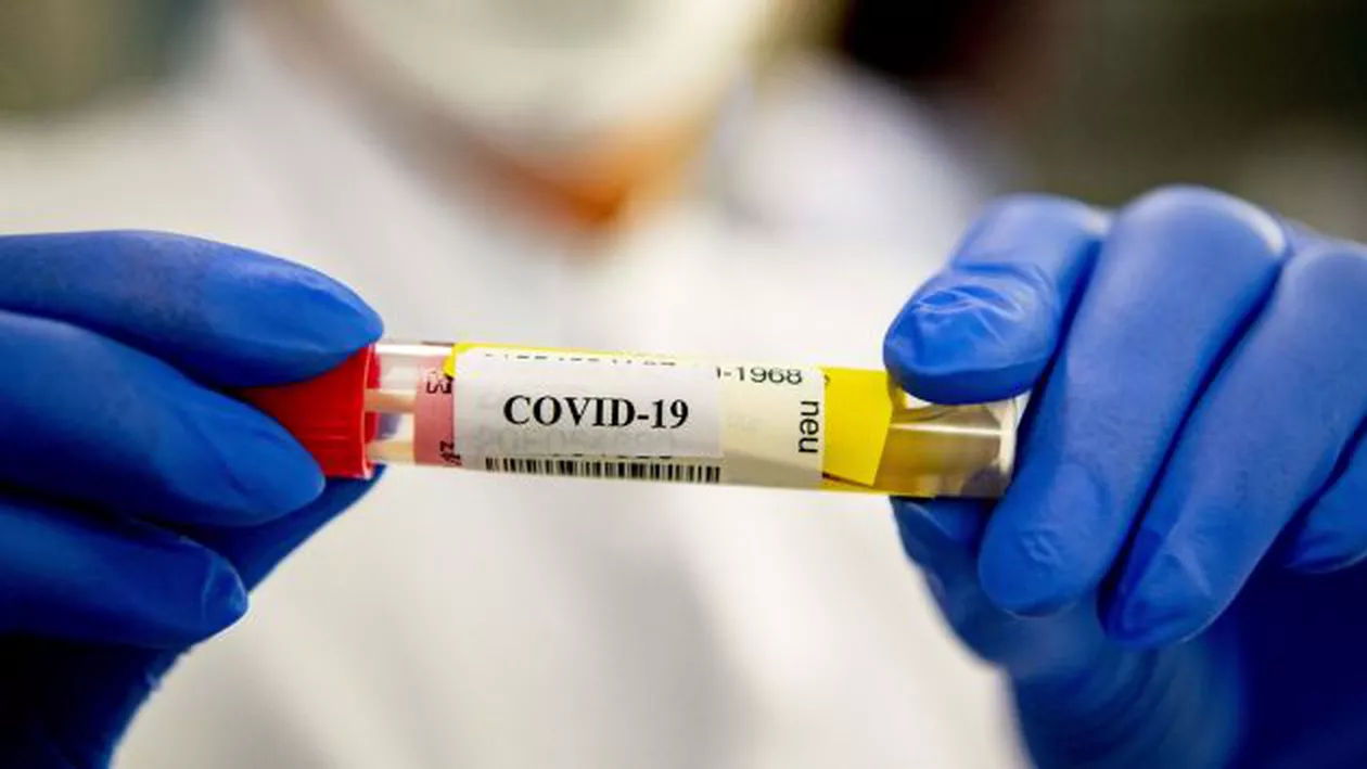 456 de cazuri noi de COVID-19 și 13 decese în 24 de ore. La terapie intensivă sunt internați 243 de pacienți depistați cu coronavirus