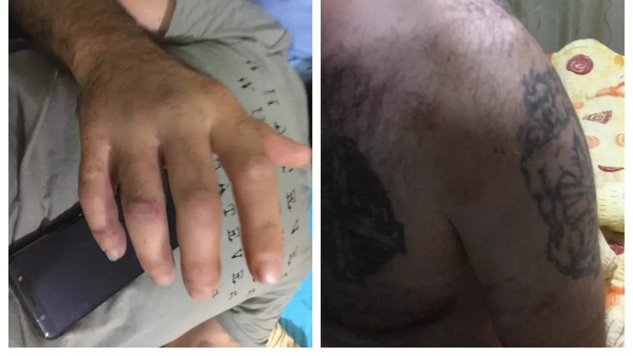 Un tânăr din Capitală acuză că a fost bătut cu bestialitate de polițiști, după ce le-a atras atenția că nu poartă mască