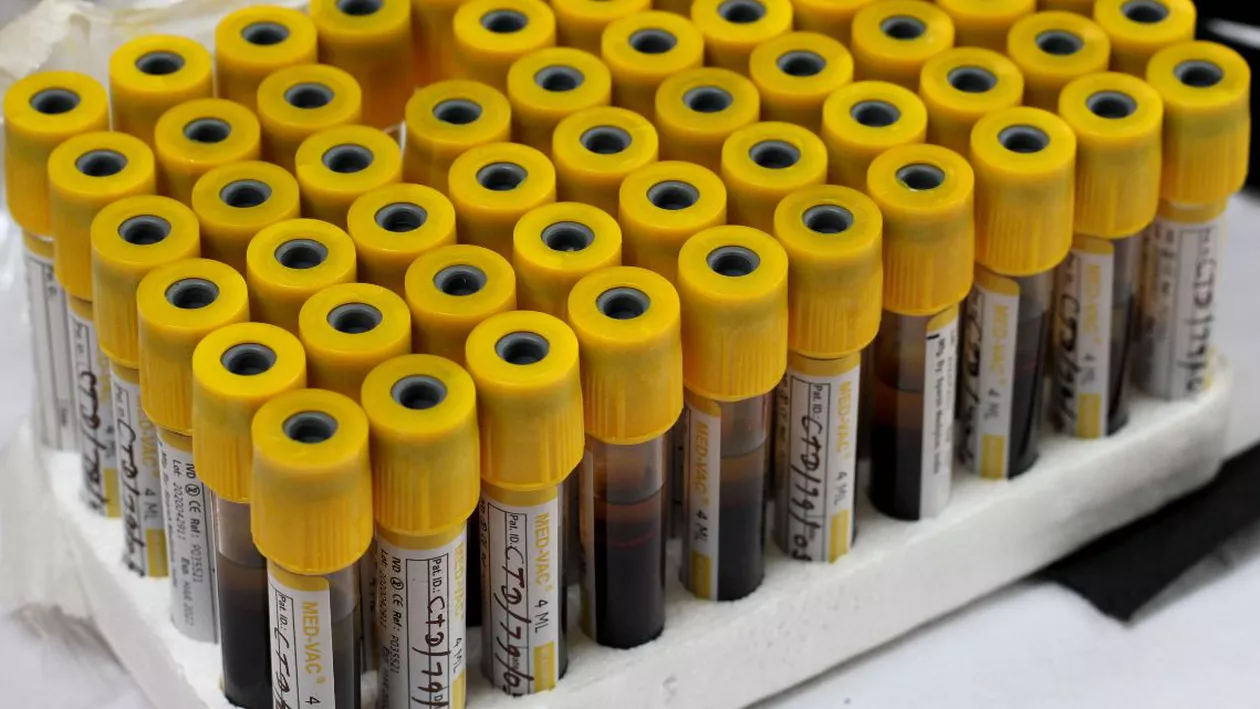 CORONAVIRUS | 5.753 de noi cazuri de COVID-19, în România. Record la ATI - 923 de persoane, în stare gravă. Alți 101 pacienți au murit