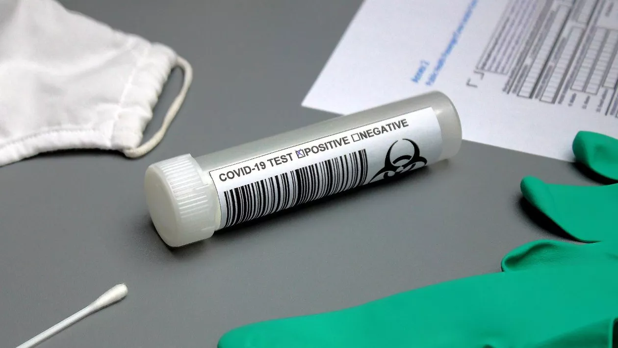 CORONAVIRUS | Aproape 9.500 de noi îmbolnăviri în 24 de ore. 1.149 de pacienți sunt internați la ATI și alți 174 au murit