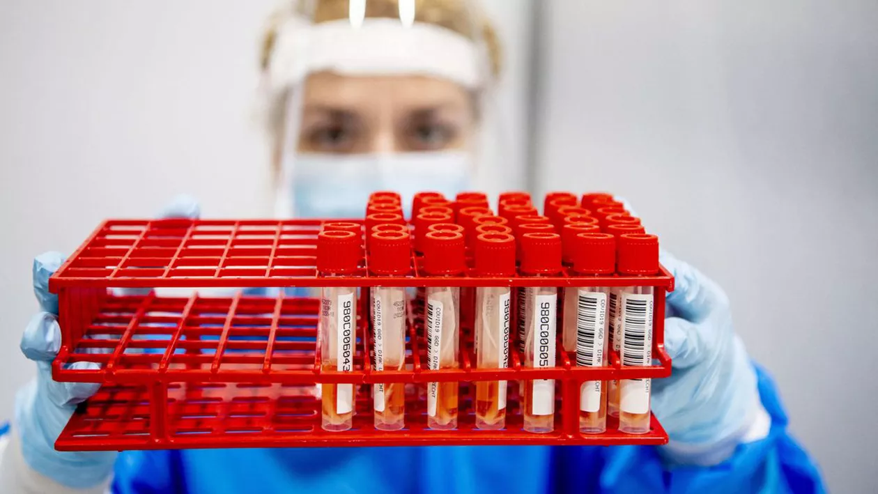 CORONAVIRUS | Studiu: Covid-19 poate cauza anomalii la nivelul plămânilor detectabile după mai mult de trei luni de când pacientul a fost infectat