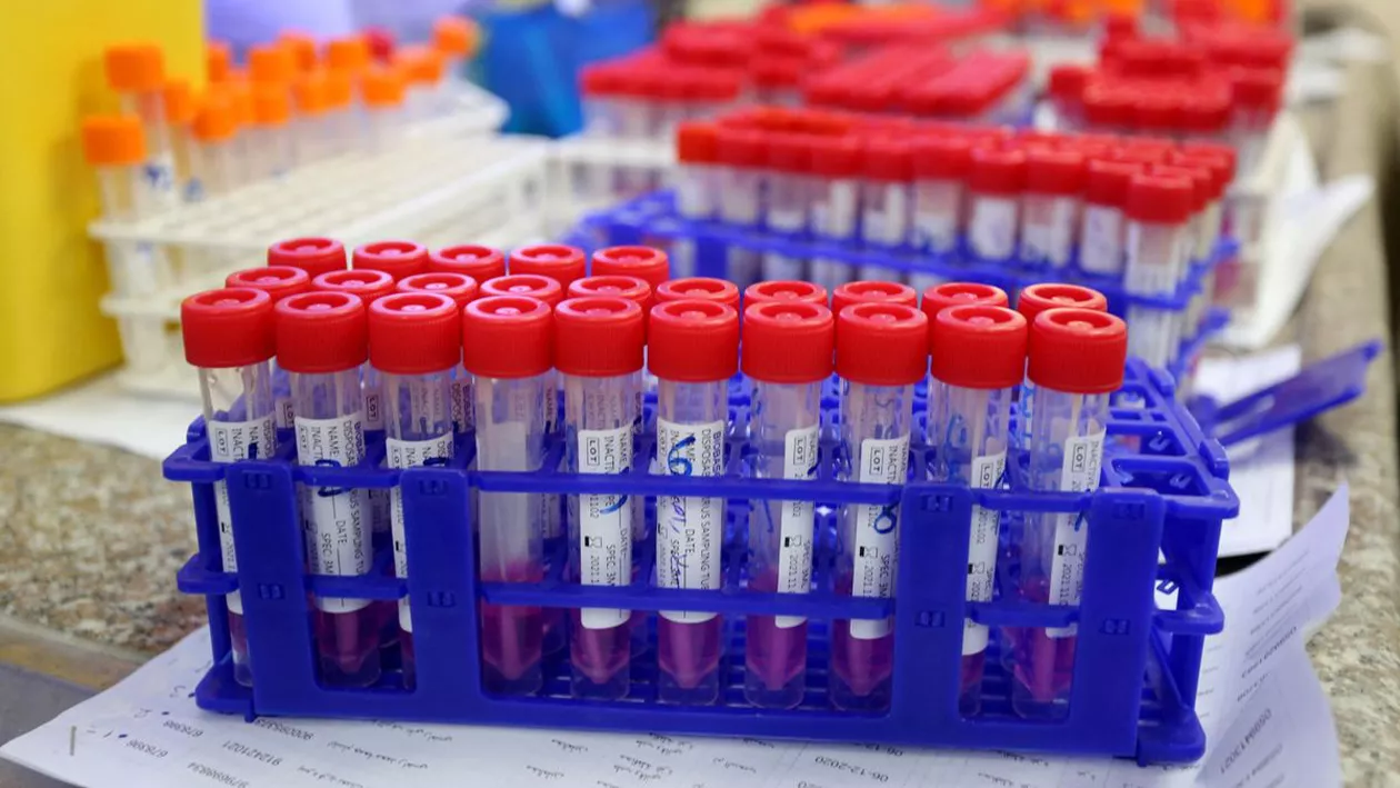 CORONAVIRUS | Peste 1.100 de noi cazuri de COVID-19, din 4.438 de teste. 1.117 pacienți sunt internați la terapie intensivă, iar alți 78 au decedat