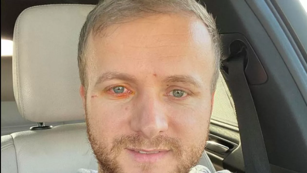 Daniel Bodnar s-a trezit din anestezie, după o operație complicată. Medicii i-au descoperit leziuni importante la nivelul măduvei spinării