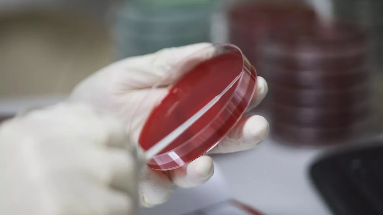 INSP: 557 de cazuri de COVID-19 cu tulpina britanică, 3 cu tulpina sud-africană și 2 cu cea braziliană, confirmate până în 28 martie. Au fost înregistrate 17 decese