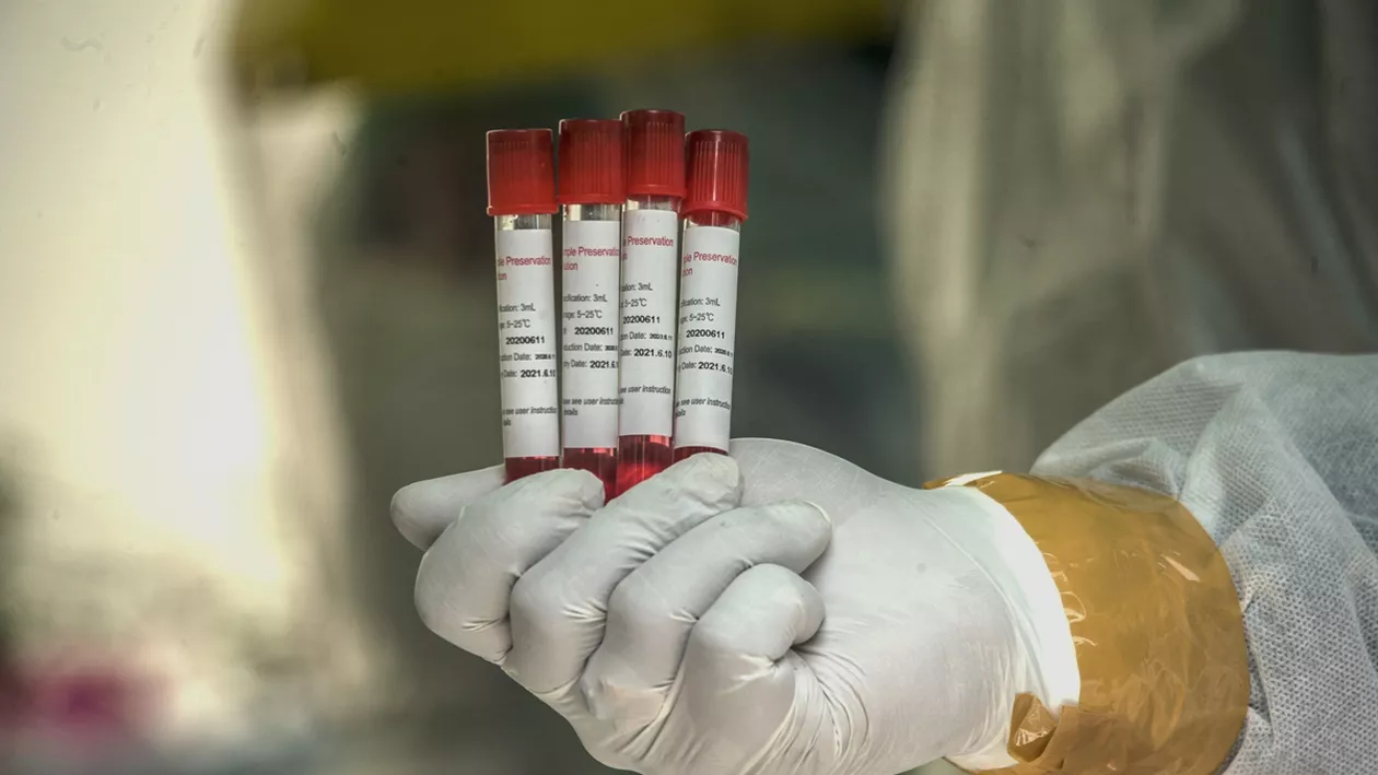 Bilanțul infecțiilor cu coronavirus pe județe. Cele mai multe cazuri noi sunt în București, 1.072