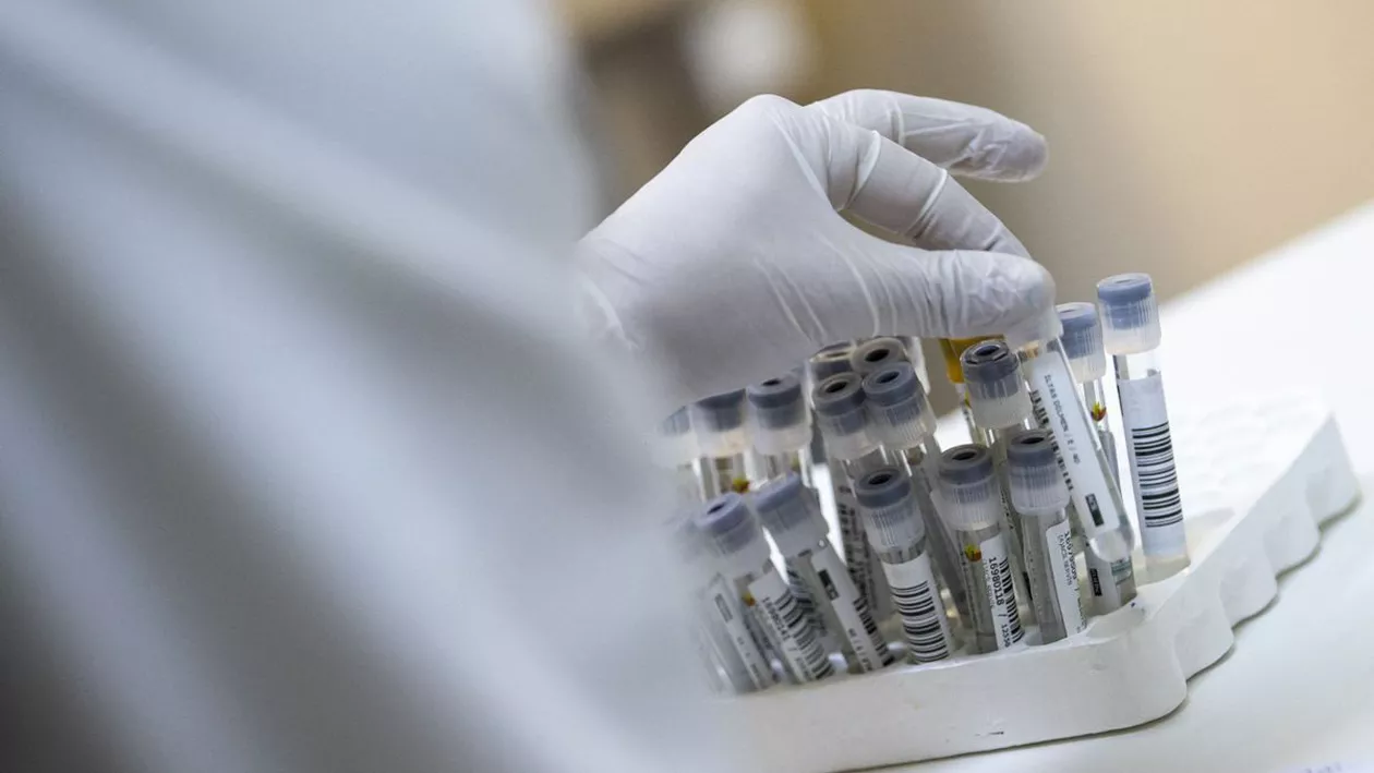 CORONAVIRUS | Aproape 4.000 de noi îmbolnăviri din peste 37.000 de teste. 1.518 pacienți sunt internați la ATI, iar alți 195 au murit